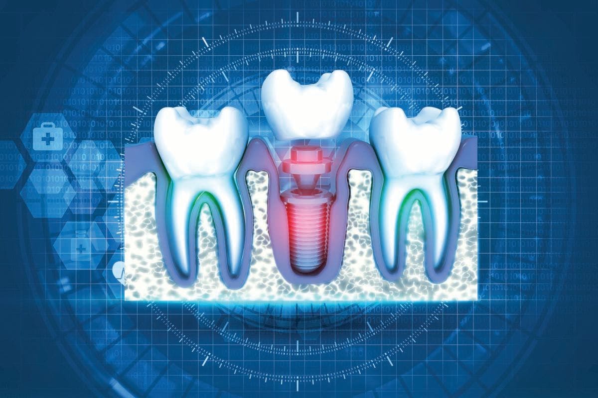 Special Report: New Frontiers of Dental Implants | © Crystal Light -stock.adobe.com