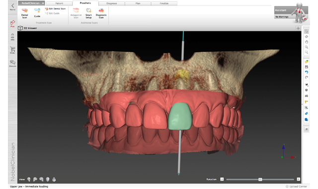How the digital revolution is making an impact on implant treatment
