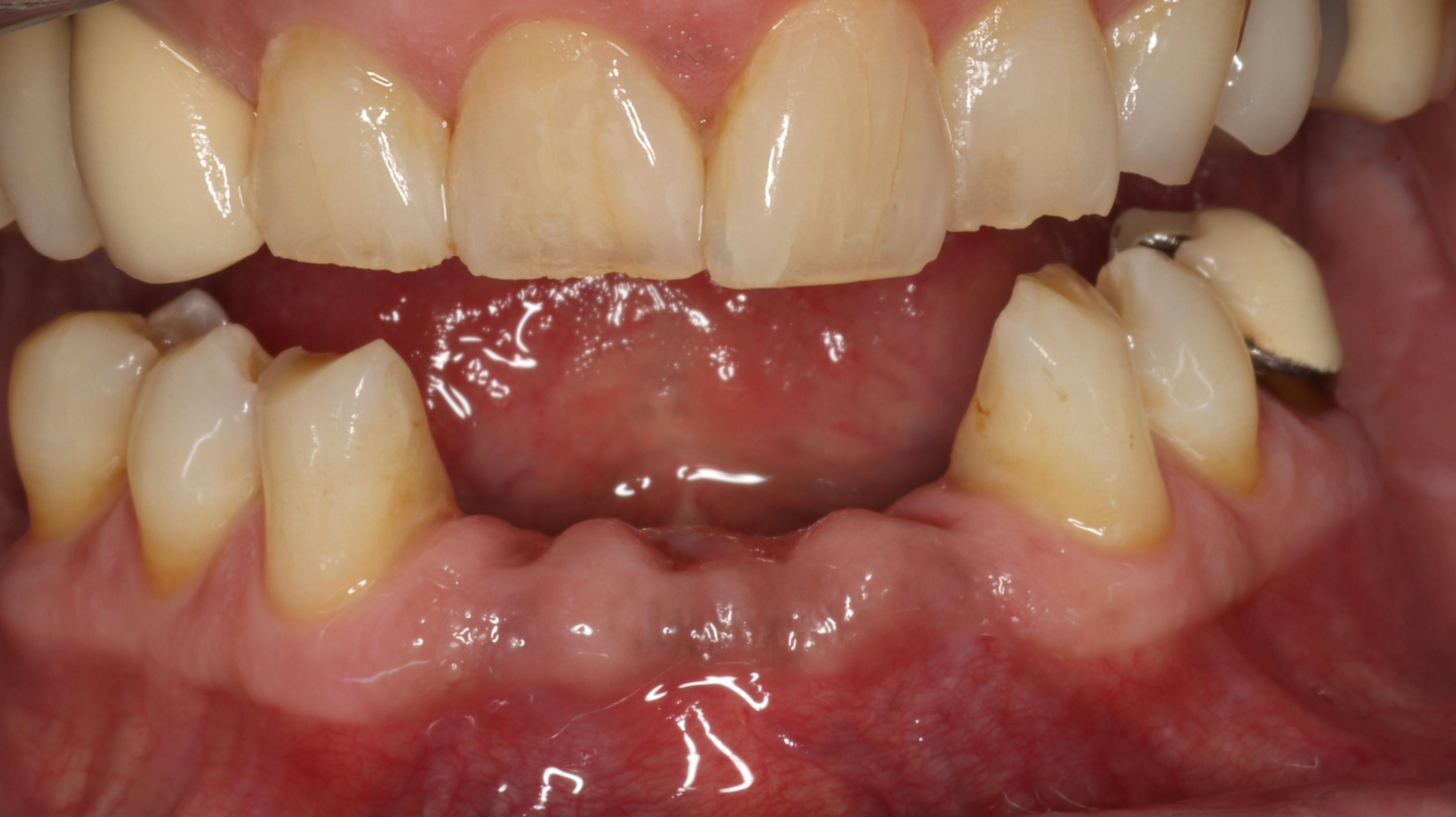 Case Report: EndoPilot Technology Expedites Multidisciplinary Dental Therapies