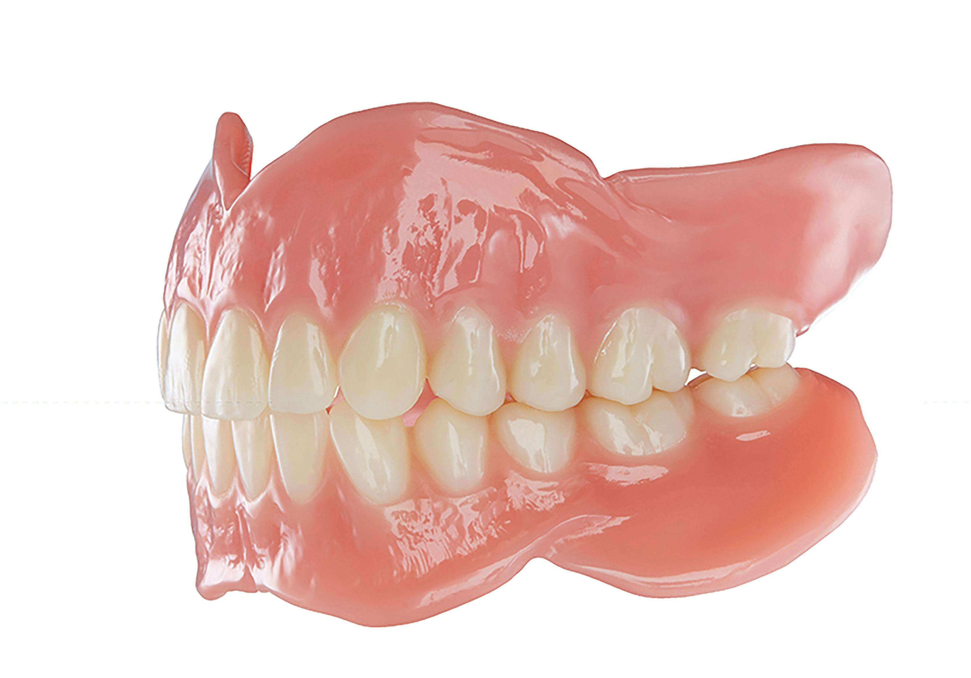 A set of dentures completed using the Baltic Denture System.