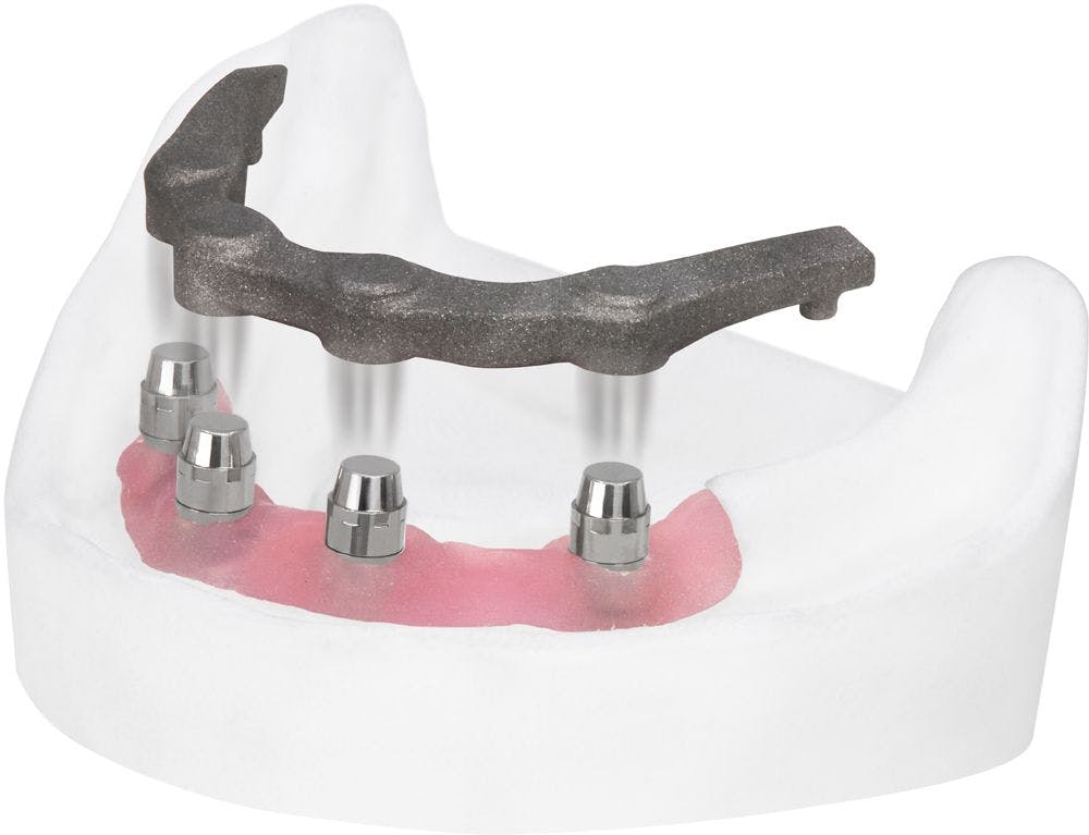 Described as the world’s first removable magnetic implant bar, the Magnet-X provides permanent stable magnetic retention that maintains the denture in place.