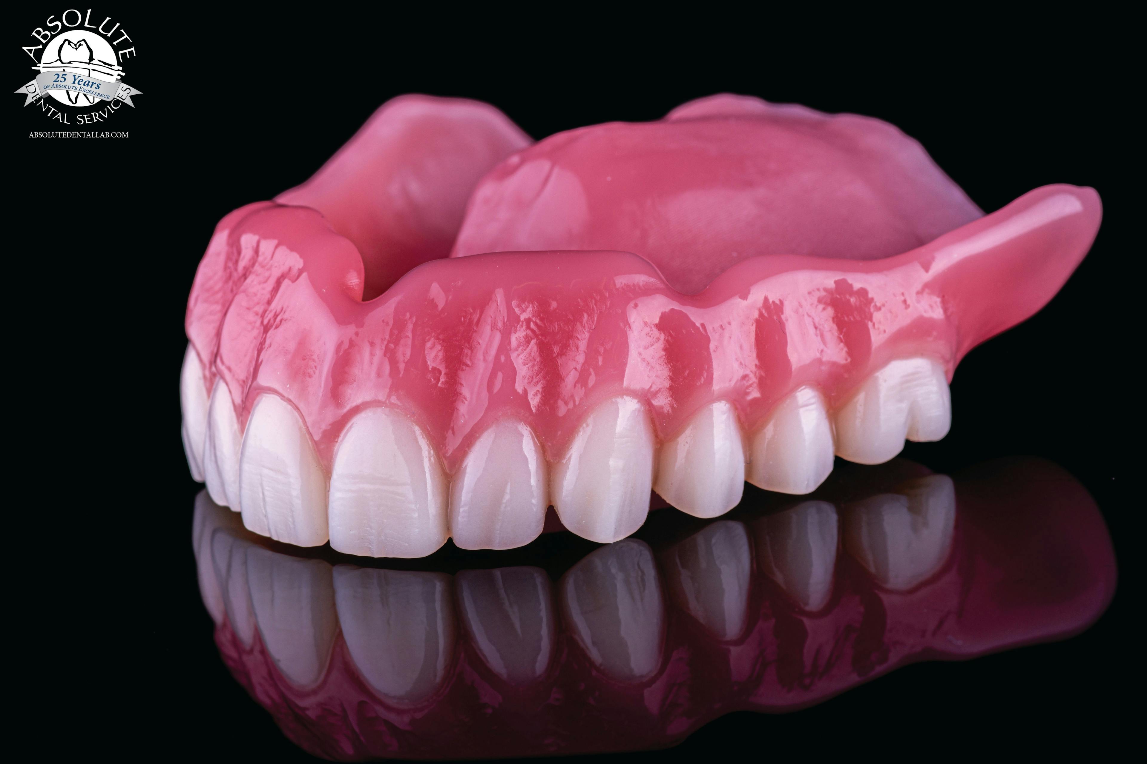 3D-printed, Lucitone Denture.