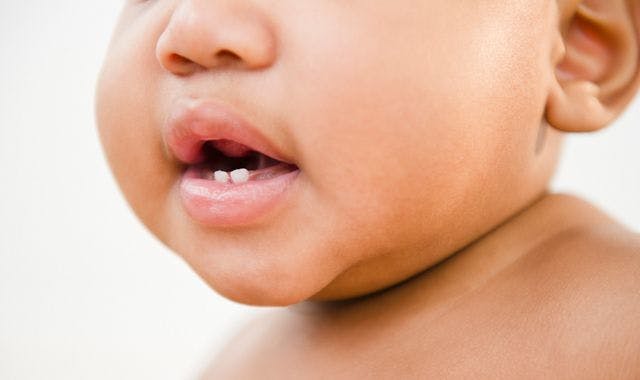 Dental surprise: Missouri baby born with two teeth