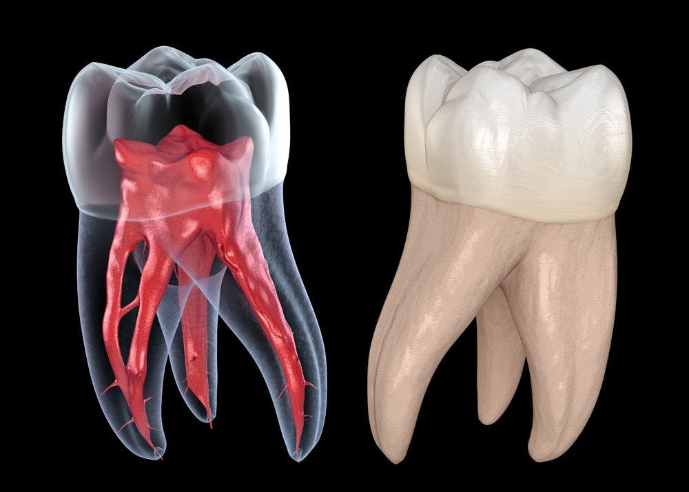 Different Ways to Protect Dental Pulp. Photo by Alexandr Mitiuc/stock.adobe.com. 