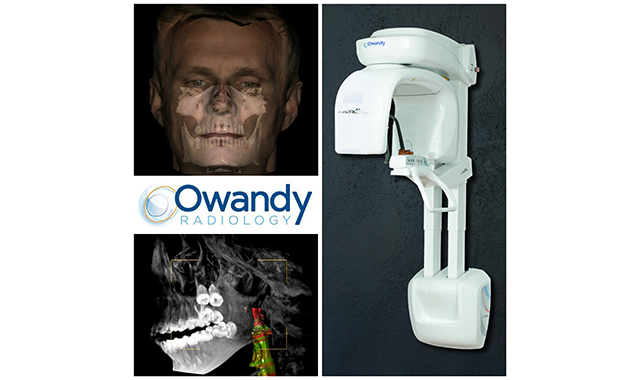 Owandy Radiology upgrades its I-Max 3D CBCT System