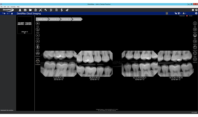 DentiMax announces DentiMax Cloud Imaging application