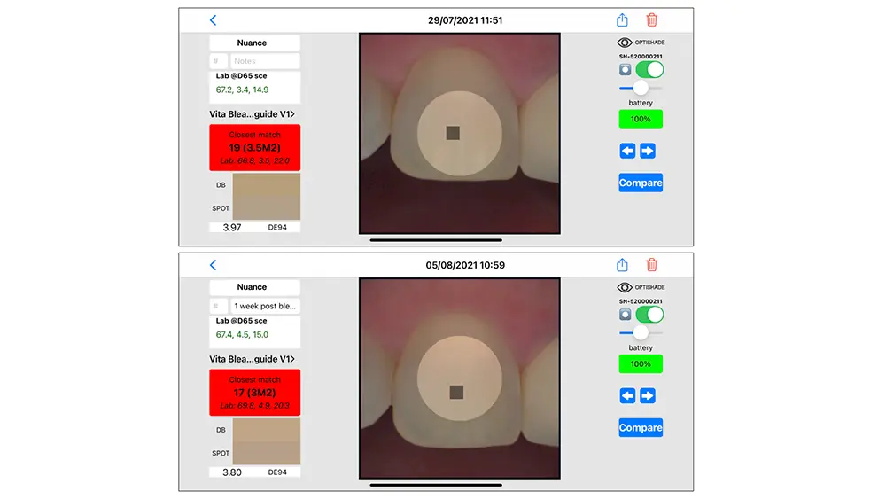 The Optishade provides objective, side-by-side comparisons and shade analysis of patients' teeth to aid in communication between clinicians and lab technicians.