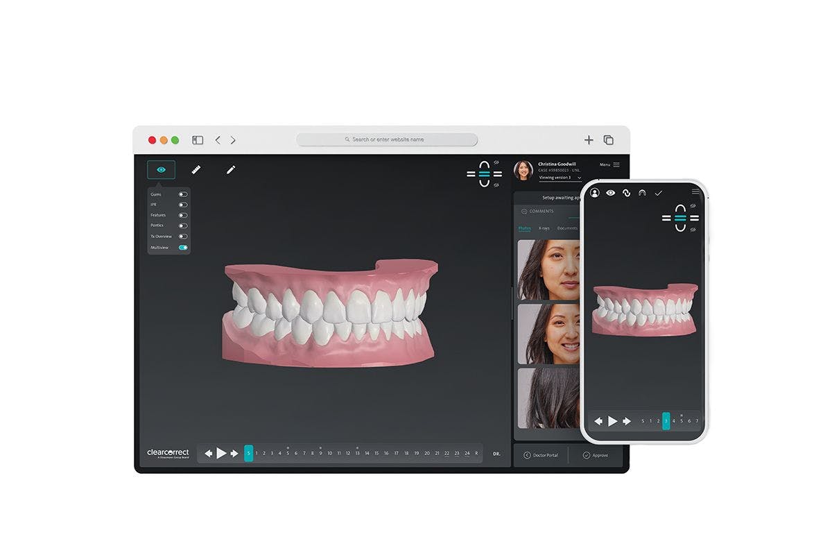 ClearCorrect® has launched a series of new orthodontic solutions and innovations designed to provide desired treatment results for an expanded group of treatable patients. | Image Credit: © ClearCorrect