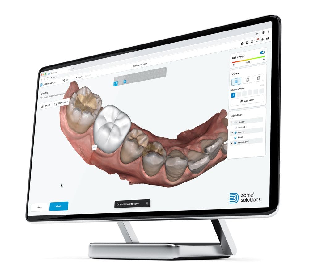 3Dme Crown is an automatic crown design module of 3Dme Solutions, Imagoworks’ AI-based web dental solutions.