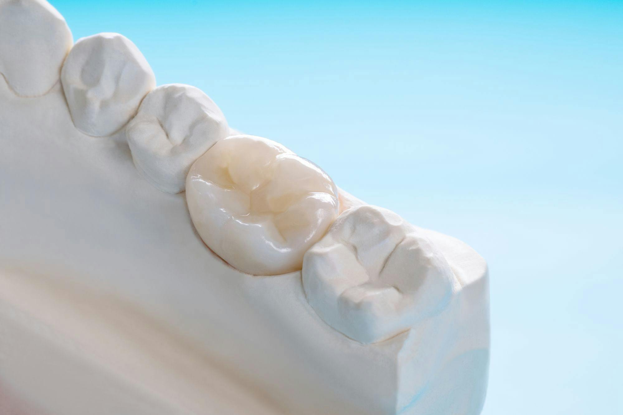 Zirconia Materials Market to Exceed $297.7 Million This Year, and Here's Why. Image courtesy of sujit/stock.adobe.com. 