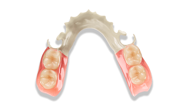 Solvay Dental releases removable partial denture study