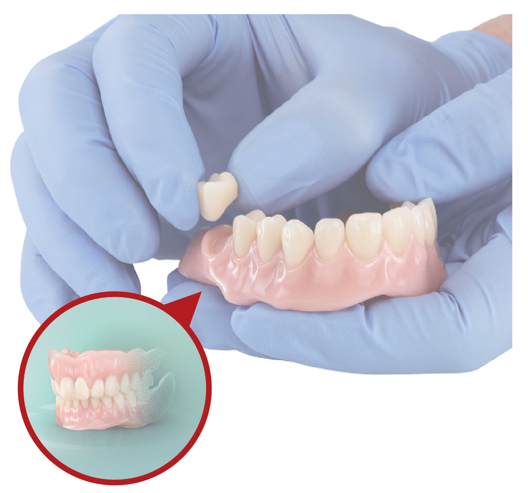 VITA VIONIC VIGO® digital denture teeth from VITA