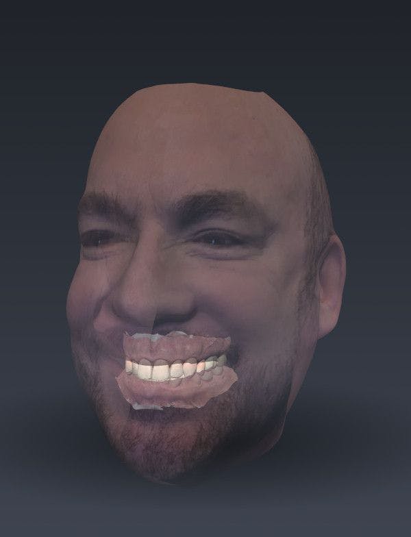 Bellus 3D face scan