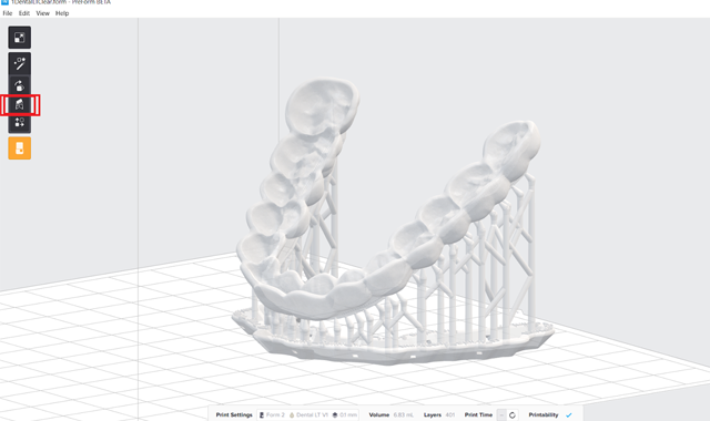 How to use 3D printing to simplify occlusal splints