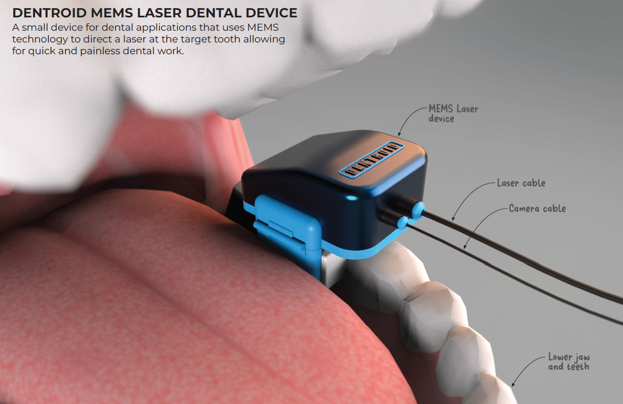 Dentroid MEMS Laser Dental Device | ©Dentroid