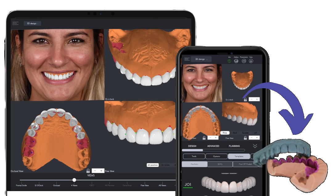 New Smilefy 4.0 Features Innovative 3D Smile Design Powered by AI | Image Credit: © Smilefy, Inc 