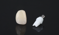 To maximize esthetics in the smile zone, the final restoration consisted of a BruxZirÂ® Anterior crown over an Inclusive Custom Zirconia Abutment with titanium base.