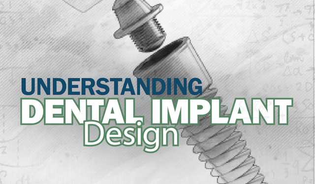 Understanding Dental Implant Design. Image credit: © MclittleStock; 9george / stock.adobe.com