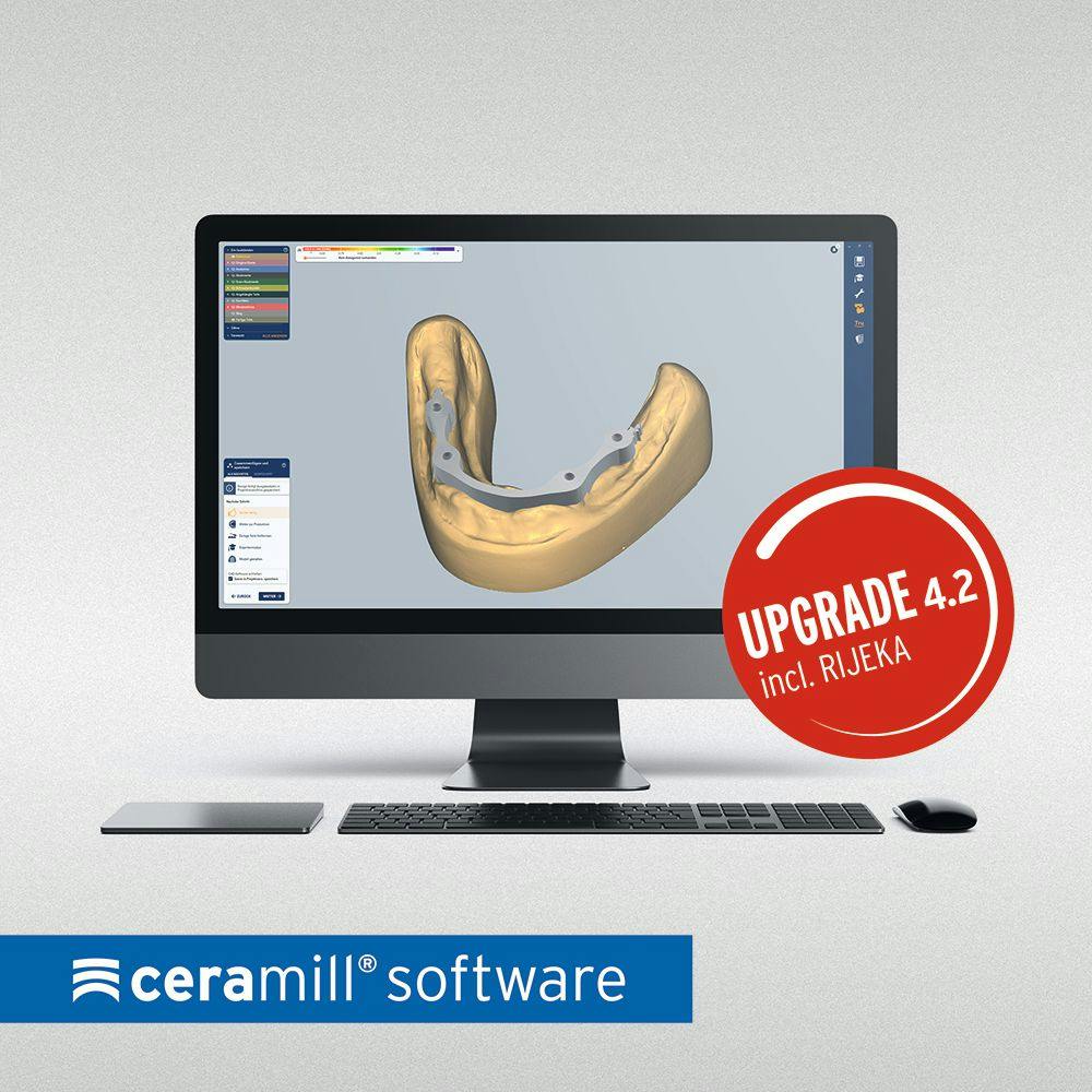 Amann Girrbach’s Software Update Brings Next Generation In-House Dental Fabrication Processes