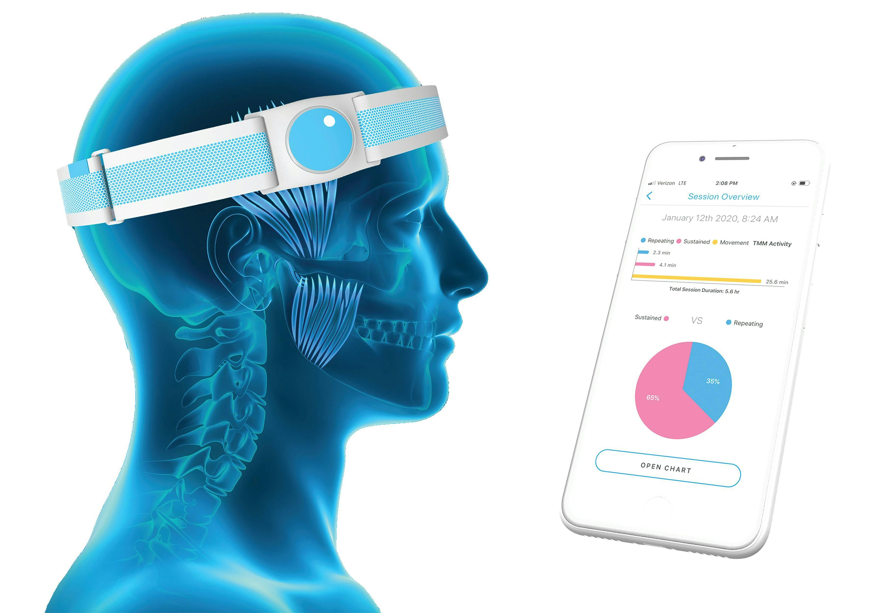 BruxRelief is a wearable AI device that collects bruxism activity while a patient sleeps and records that data in its app.
