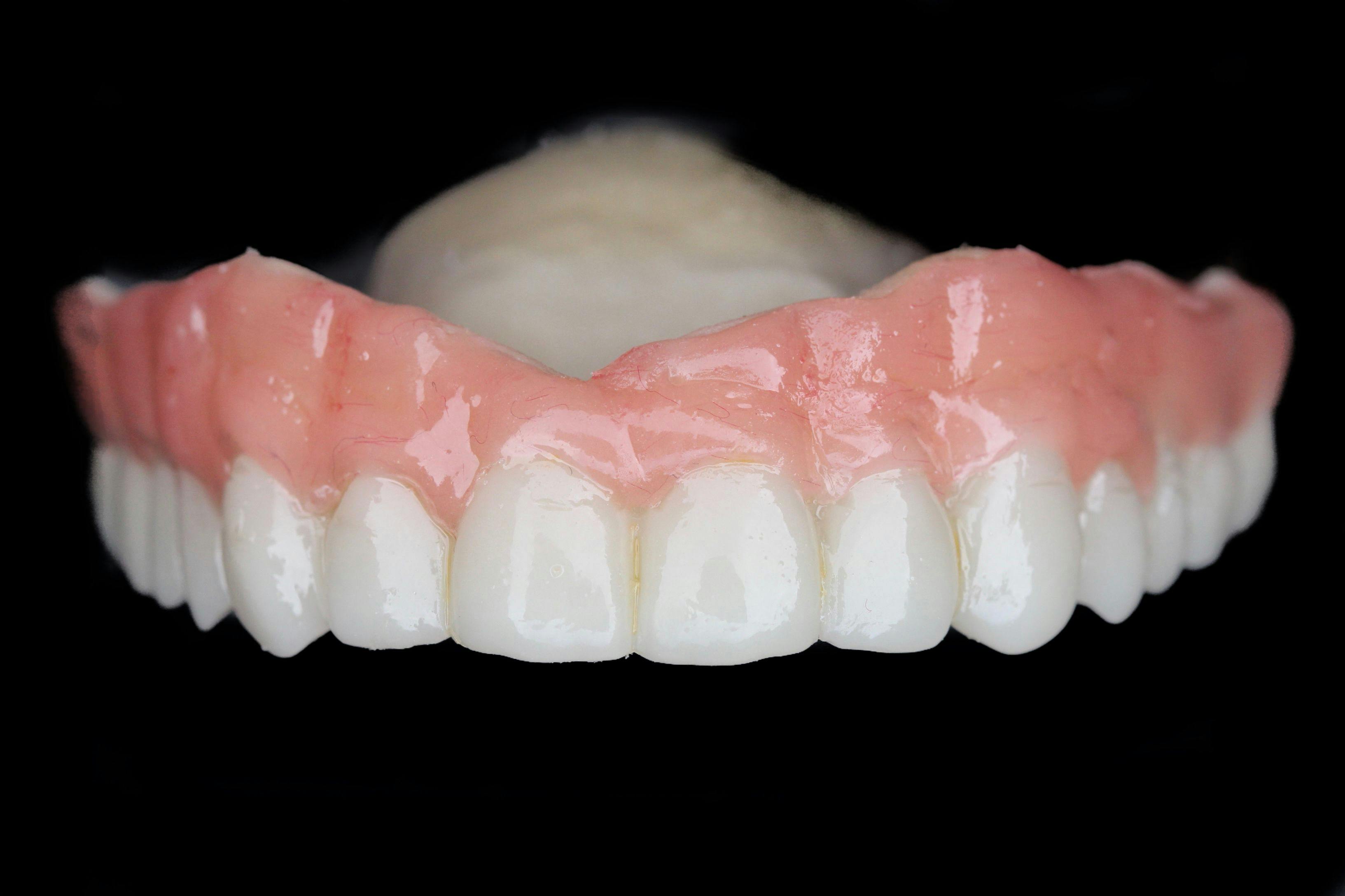 How to Use the Medit i700 for a Two-Day Digital Denture Workflow