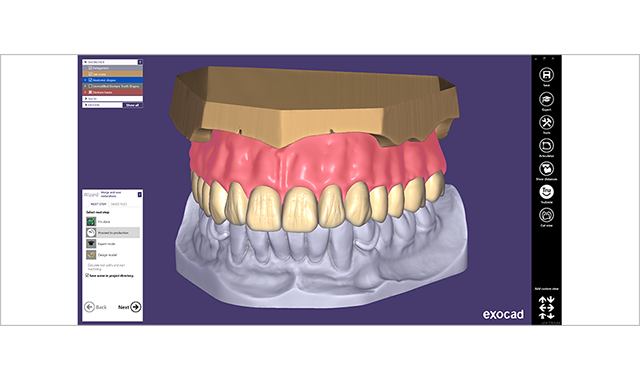 exocad DentalCAD 2.4 Plovdiv available now