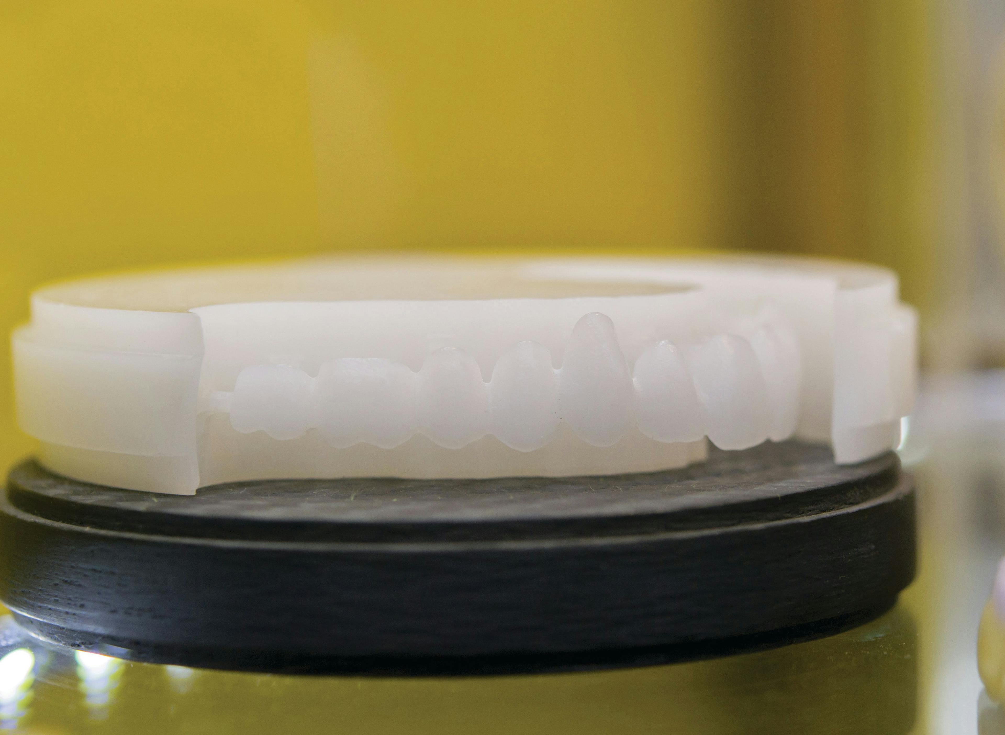 Digital Dentistry Offerings Made Great by Today’s Dental Lab Materials 
