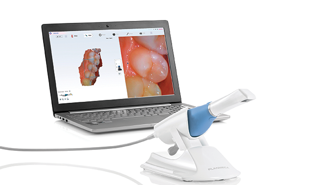 Closer Look: Taking intraoral scanning to the next level