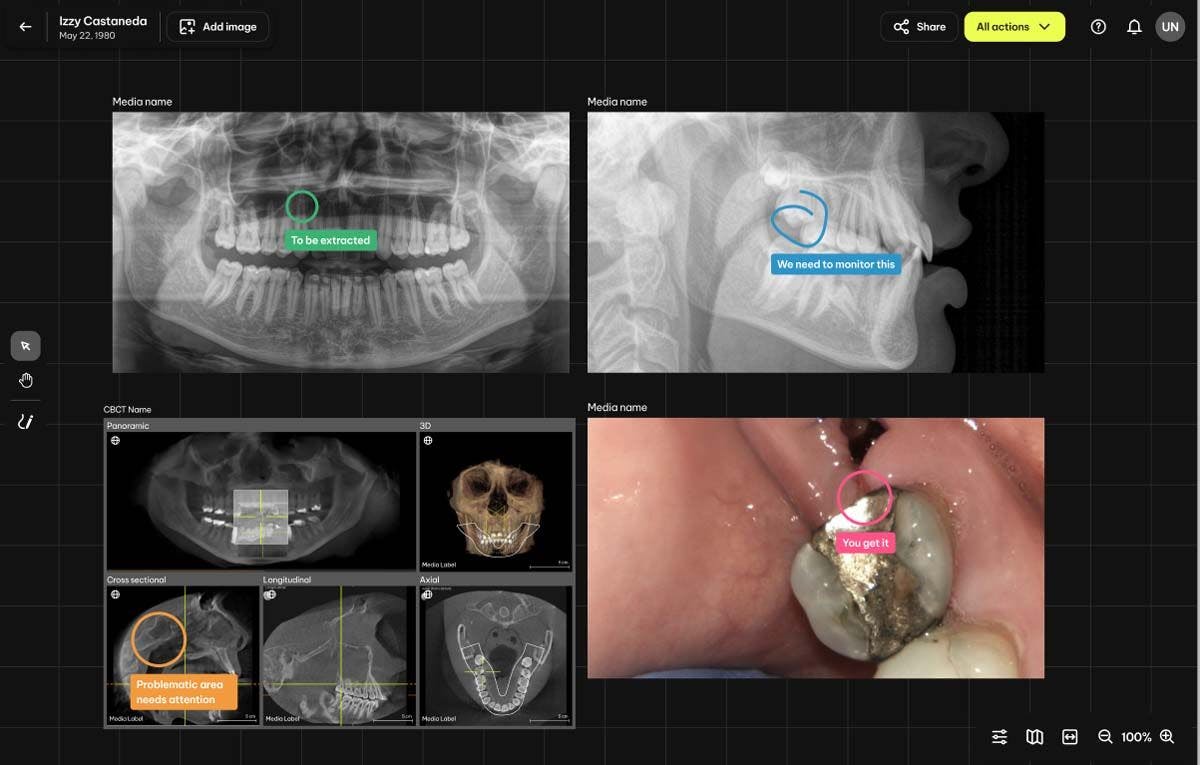 Dentsply Sirona Updates DS Core with New Features. Image credit: © Dentsply Sirona