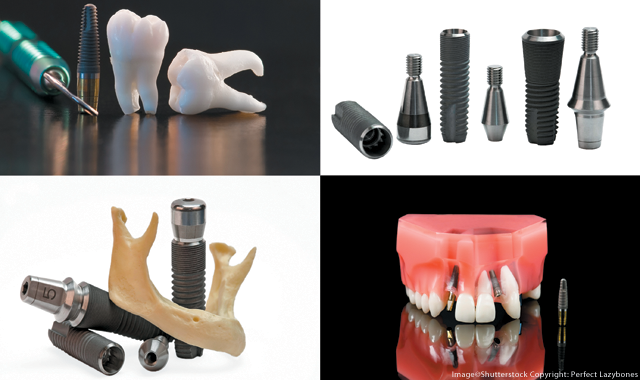 What digital dentistry means for implants