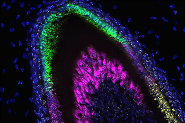 Colors signify which genes are being expressed at each stage of development in this image of a developing incisor. | Image Credit: © UW Dental Organoid Research Team