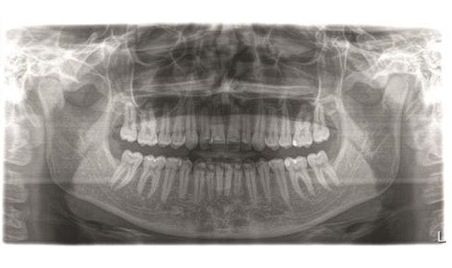 A panoramic x-ray