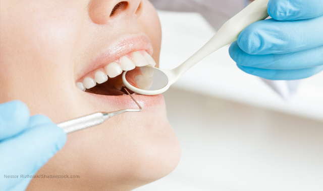 What you need to know about gum disease