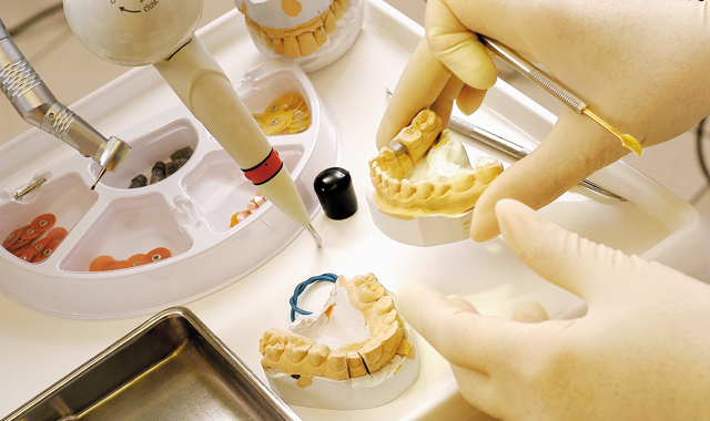 a photo of dental models on a dental lab benchtop