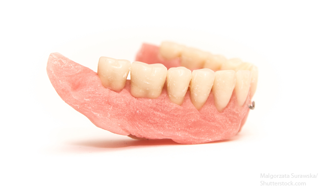 The 5 Craziest Denture Tips on the Internet