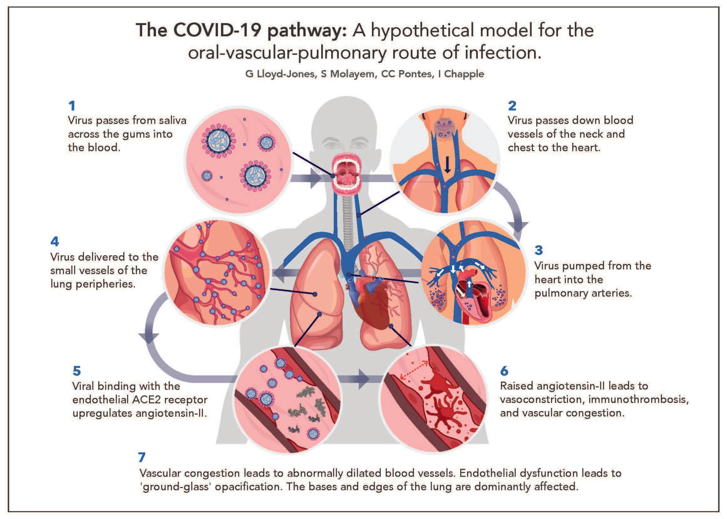 New Research Shows Link Between COVID-19 Transmission and Poor Oral Hygiene