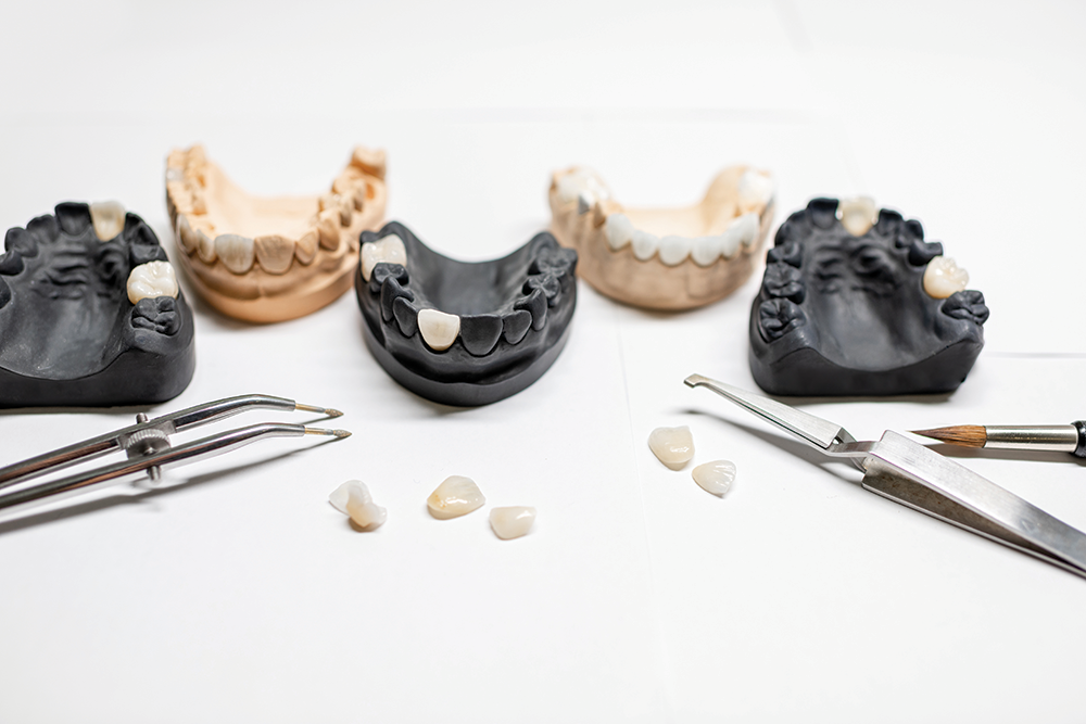 Dental crowns and veneers on models and the bench – rh2010 / stock.adobe.com
