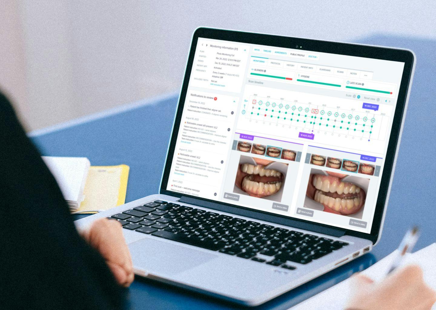 A System to Keep Practices and Clear Aligner Patients Connected