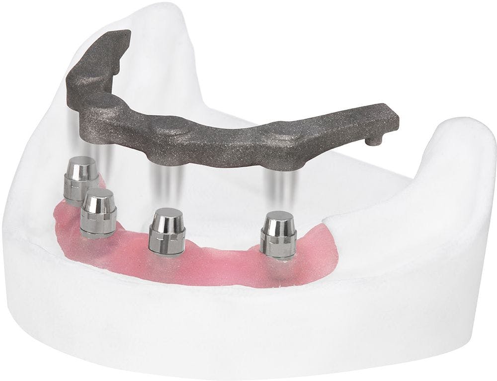 Panthera Dental Debuts Its New Removable Magnetic Implant Bar at IDS