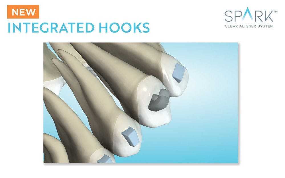 Spark's proprietary Integrated Hooks are an innovative alternative to current hook or button aligner cutouts when elastics are needed in treatment