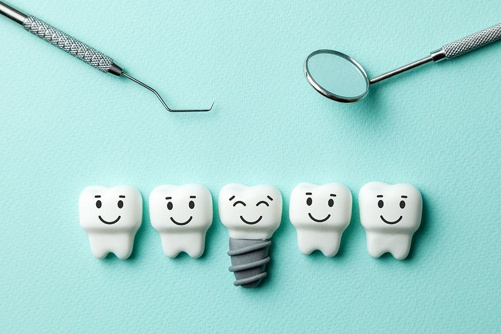 Tag-Team Implant Planning: How to Work with Your Clients to Plan the Best Implant Restorations