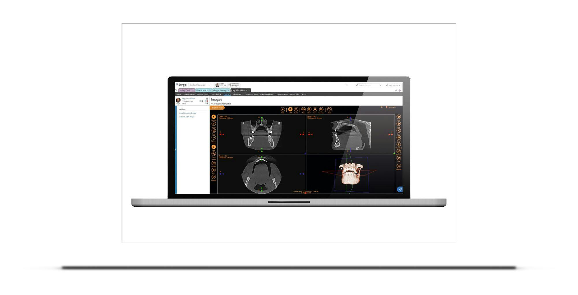 Carestream Dental Launches Cloud Practice Management Solution for Oral Surgery