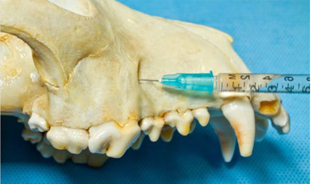 Dental injections