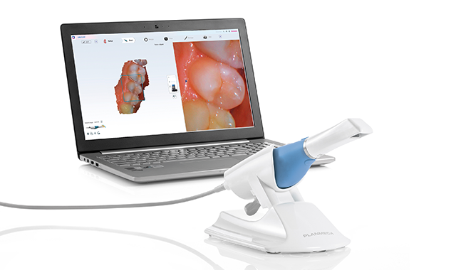 Planmeca launches Emerald S intraoral scanner