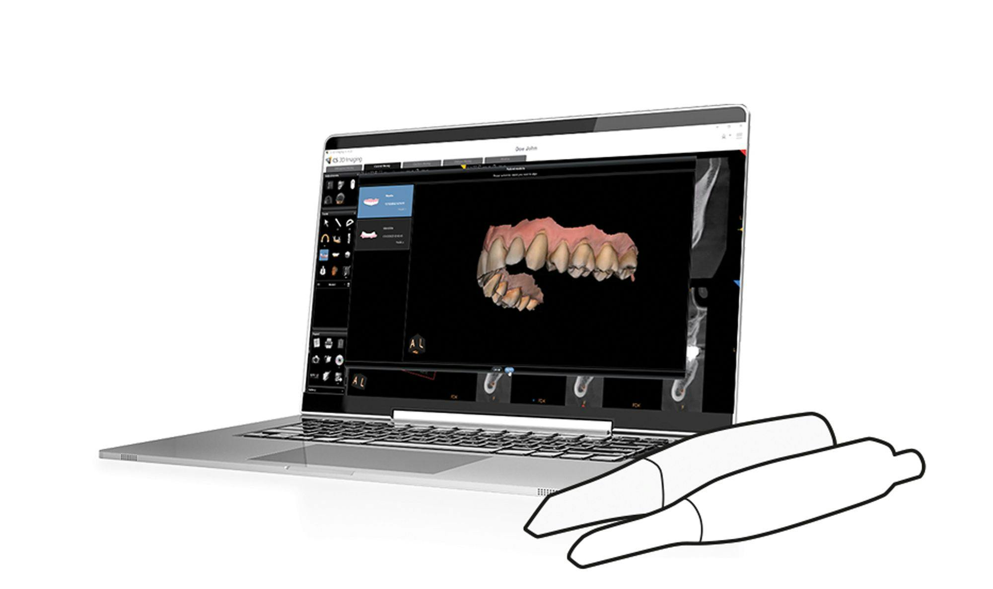IO Scanner Link | Image Credit: Carestream Dental