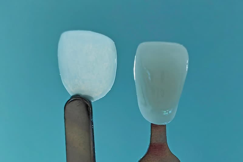 An UltraThineer, (left) compared with a standard zirconia veneer, (right). | Credit: © Boston Micro Fabrication