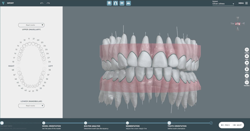 SoftSmile's VISION orthodontic software  