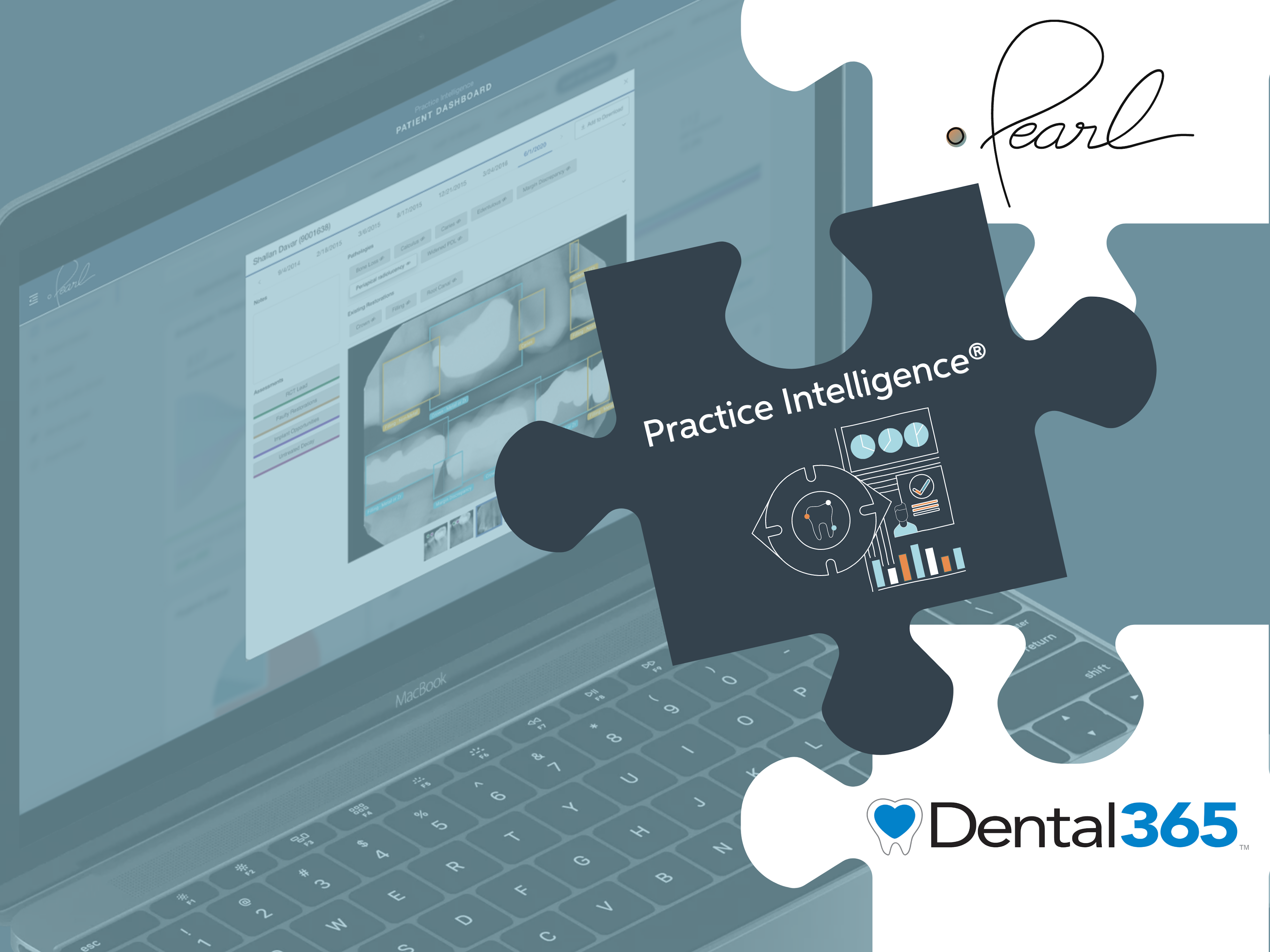 Pearl Partners with Dental Service Organization Dental365