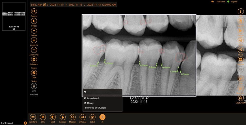 Planet DDS and Overjet Working Together on AI-Powered Dental Imaging