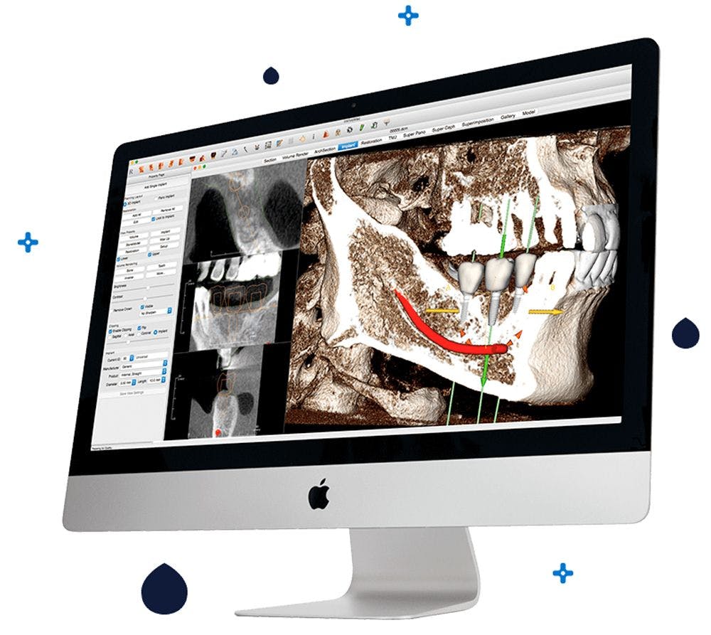 Anatomage Announces Osteoid Dental Subsidiary